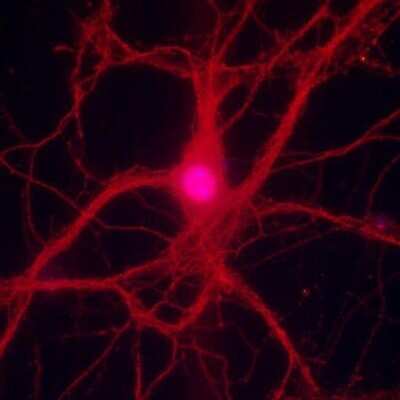 Immunocytochemistry/Immunofluorescence: LRRTM2 Antibody [NBP2-41129] - LRRTM2 staning is detected in neurites and cell bodies in mouse cortical neurons (dilution: 1:100 [red], DAPI: blue). This image was submitted via customer Review.