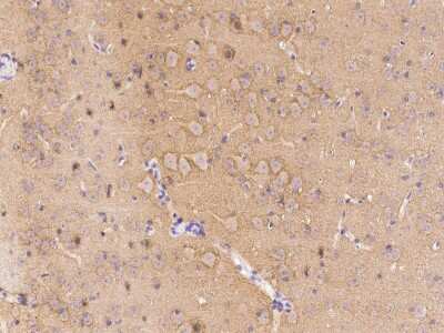 Immunohistochemistry-Paraffin: LRRTM2 Antibody [NBP2-98780] - Immunochemical staining LRRTM2 in human brain with rabbit polyclonal antibody (1:1000, formalin-fixed paraffin embedded sections).