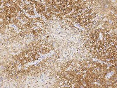 Immunohistochemistry-Paraffin LRRTM2 Antibody - Azide and BSA Free
