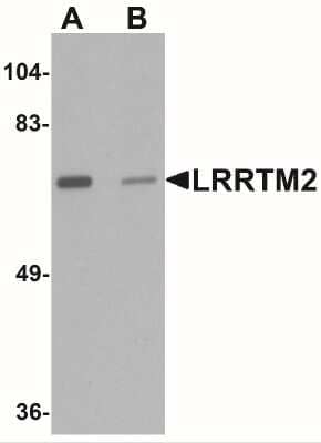 Western Blot LRRTM2 Antibody - BSA Free