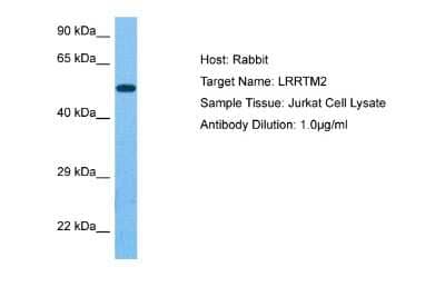 Western Blot: LRRTM2 Antibody [NBP2-86703] - Host: Rabbit. Target Name: LRRTM2. Sample Tissue: Human Jurkat Whole Cell. Antibody Dilution: 1.0ug/ml
