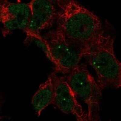 Immunocytochemistry/Immunofluorescence: LRRTM3 Antibody [NBP3-17882] - Staining of human cell line HAP1 shows localization to nucleoplasm & nuclear bodies.