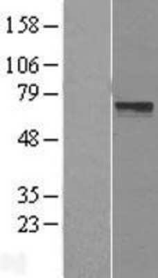 Western Blot: LRRTM3 Overexpression Lysate (Adult Normal) [NBL1-12715] Left-Empty vector transfected control cell lysate (HEK293 cell lysate); Right -Over-expression Lysate for LRRTM3.