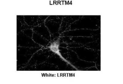 Immunohistochemistry: LRRTM4 Antibody [NBP1-69616] - Rat Hippocampal Neurons - 14DIV Primary Antibody Dilution: 1 : 200 Secondary Antibody: Anti-rabbit-Cy3 Secondary Antibody Dilution: 1 : 500Color/Signal Descriptions: White: LRRTM4 Gene name: LRRTM4 Submitted by: Dan Fowler - University of Oregon, Institute of Neuroscience.