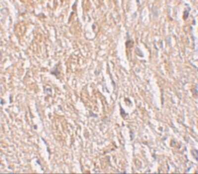 Immunohistochemistry-Paraffin: LRRTM4 Antibody [NBP1-76530] - LRRTM4 in human brain tissue with LRRTM4 antibody at 2.5 ug/mL.