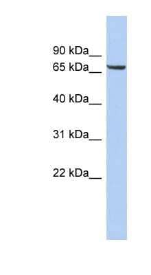 Western Blot: LRRTM4 Antibody [NBP1-62611] - Titration: 0.2-1 ug/ml, Positive Control: OVCAR-3 cell lysate.