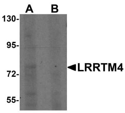 Western Blot LRRTM4 Antibody - BSA Free