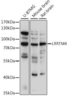 Western Blot: LRRTM4 Antibody [NBP3-04951] - Analysis of extracts of various cell lines, using LRRTM4 antibody at 1:1000 dilution. Secondary antibody: HRP Goat Anti-Rabbit IgG (H+L) at 1:10000 dilution. Lysates/proteins: 25ug per lane. Blocking buffer: 3% nonfat dry milk in TBST. Detection: ECL Basic Kit