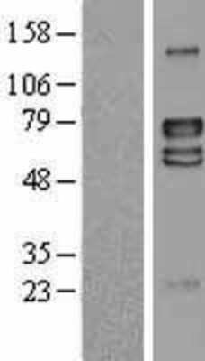 Western Blot: LRRTM4 Overexpression Lysate (Adult Normal) [NBL1-12716] Left-Empty vector transfected control cell lysate (HEK293 cell lysate); Right -Over-expression Lysate for LRRTM4.