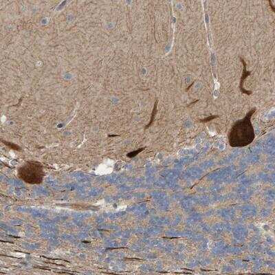 Immunohistochemistry-Paraffin: LRSAM1 Antibody [NBP1-82017] - Staining of human cerebellum shows strong cytoplasmic positivity in purkinje cells.