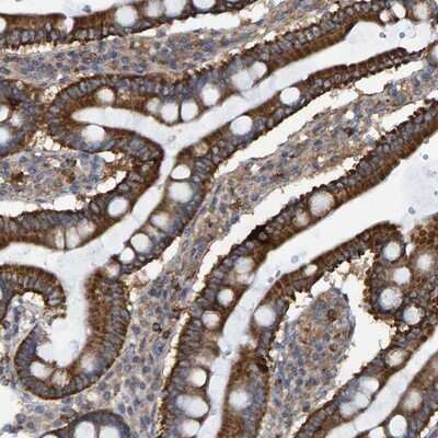 Immunohistochemistry-Paraffin: LRSAM1 Antibody [NBP1-82016] - Staining of human duodenum shows strong cytoplasmic positivity in glandular cells.