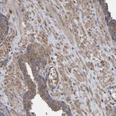 Immunohistochemistry-Paraffin: LRSAM1 Antibody [NBP1-82016] - Staining of human prostate shows moderate cytoplasmic positivity in smooth muscle cells.