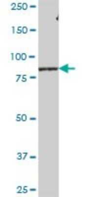 Western Blot: LRSAM1 Antibody [H00090678-B01P] - Analysis of LRSAM1 expression in human liver.