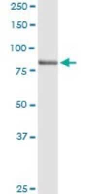 Western Blot: LRSAM1 Antibody [H00090678-D01P] - Analysis of LRSAM1 expression in human liver.