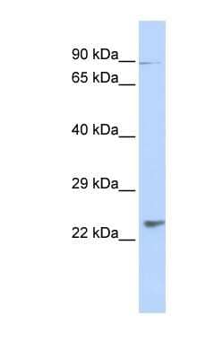 Western Blot: LRTOMT Antibody [NBP1-70628] - Human Heart lysate, concentration 0.2-1 ug/ml.