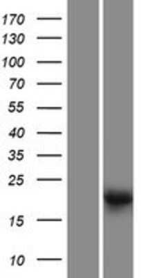 Western Blot: LRTOMT Overexpression Lysate (Adult Normal) [NBP2-05486] Left-Empty vector transfected control cell lysate (HEK293 cell lysate); Right -Over-expression Lysate for LRTOMT.