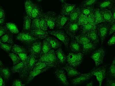 Immunocytochemistry/Immunofluorescence: LRWD1 Antibody [NBP2-97339] - Immunofluorescence staining of LRWD1 in U2OS cells. Cells were fixed with 4% PFA, permeabilzed with 0.1% Triton X-100 in PBS, blocked with 10% serum, and incubated with rabbit anti-Human LRWD1 polyclonal antibody (dilution ratio 1:200) at 4C overnight. Then cells were stained with the Alexa Fluor(R)488-conjugated Goat Anti-rabbit IgG secondary antibody (green). Positive staining was localized to Nucleus and Cytoplasm.