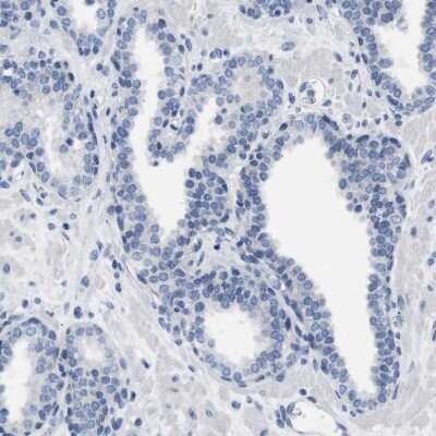 Immunohistochemistry-Paraffin LRWD1 Antibody