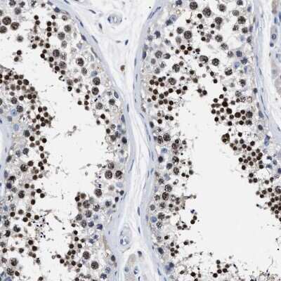 Immunohistochemistry-Paraffin LRWD1 Antibody