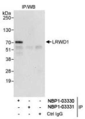 Immunoprecipitation: LRWD1 Antibody [NBP1-03330] - Detection of Human LRWD1 by Western Blot of  Immunoprecipitates. Samples: Whole cell lysate (1 mg for IP,  20% of IP loaded) from HeLa cells. Antibodies: Affinity purified  rabbit anti-LRWD1 antibody NBP1-03330 used for IP at 3  mcg/mg lysate