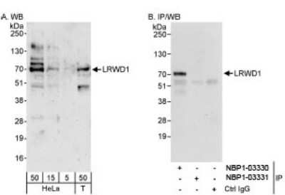 Western Blot: LRWD1 Antibody [NBP1-03331] - Detection of Human LRWD1 on HeLa whole cell lysate using NBP1-03331. LRWD1  was successfully immunoprecipitated by rabbit anti-LRWD1  antibody NBP1-03330.