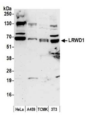 Western Blot: LRWD1 Antibody [NBP1-03331] - Detection of Human and Mouse LRWD1 by Western Blot. Samples: Whole cell lysate (50 ug) from HeLa, A459, mouse TCMK-1, and mouse NIH3T3 cells prepared using NETN lysis buffer. Antibody: Affinity purified rabbit anti-LRWD1 antibody NBP1-03331 used for WB at 0.1 ug/ml. Detection: Chemiluminescence with an exposure time of 3 minutes.