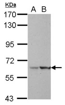 Western Blot: LRWD1 Antibody [NBP2-17176] - Sample (30 ug of whole cell lysate) A: HeLa B: HepG2 7. 5% SDS PAGE gel, diluted at 1:1000.