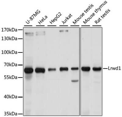 Western Blot: LRWD1 Antibody [NBP3-03939] - Analysis of extracts of various cell lines, using LRWD1 antibody at 1:1000 dilution. Secondary antibody: HRP Goat Anti-Rabbit IgG (H+L) at 1:10000 dilution. Lysates/proteins: 25ug per lane. Blocking buffer: 3% nonfat dry milk in TBST. Detection: ECL Basic Kit.