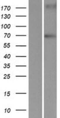 Western Blot: LRWD1 Overexpression Lysate (Adult Normal) [NBP2-05302] Left-Empty vector transfected control cell lysate (HEK293 cell lysate); Right -Over-expression Lysate for LRWD1.