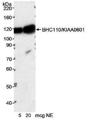 Western Blot: LSD1 Antibody [NB100-536] - Detection of Human BHC110/KIAA0601 by Western Blot. Samples: Nuclear extract (5 and 20 ug) from HeLa cells. Antibody: NB100-536 used at 0.01 ug/ml. Detection: Chemiluminescence with an exposure time of 15 minutes.