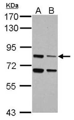 Western Blot: LSG1 Antibody [NBP2-17178] - Sample (30 ug of whole cell lysate) A: Raji B: K562 7. 5% SDS PAGE gel, diluted at 1:1000.
