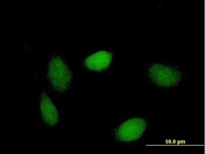 Immunocytochemistry/Immunofluorescence: LSM1 Antibody [H00027257-B01P] - Analysis of purified antibody to LSM1 on HeLa cell. (antibody concentration 10 ug/ml)