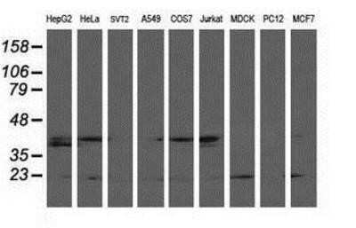 Western Blot: LSM1 Antibody (OTI5C6) - Azide and BSA Free [NBP2-72547] - Analysis of extracts (35ug) from 9 different cell lines by using anti-LSM1 monoclonal antibody.