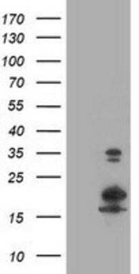 Western Blot: LSM1 Antibody (OTI5C6) - Azide and BSA Free [NBP2-72547] - HEK293T cells were transfected with the pCMV6-ENTRY control (Left lane) or pCMV6-ENTRY LSM1 (Right lane) cDNA for 48 hrs and lysed. Equivalent amounts of cell lysates (5 ug per lane) were separated by SDS-PAGE and immunoblotted with anti-LSM1.