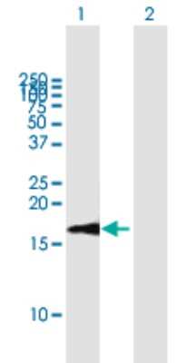 Western Blot: LSM1 Antibody [H00027257-B01P] - Analysis of LSM1 expression in transfected 293T cell line by LSM1 polyclonal antibody.  Lane 1: LSM1 transfected lysate(14.63 KDa). Lane 2: Non-transfected lysate.