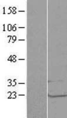 Western Blot: LSM1 Overexpression Lysate (Adult Normal) [NBL1-12720] - Western Blot experiments.  Left-Control; Right -Over-expression Lysate for LSM1