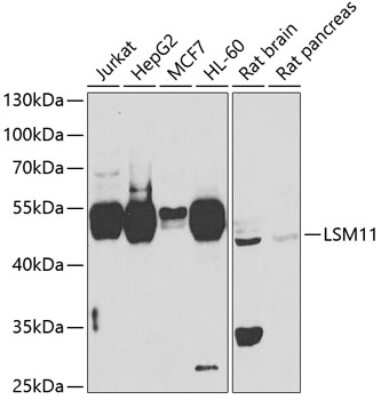 Western Blot: LSM11 Antibody [NBP3-04669] - Analysis of extracts of various cell lines, using LSM11 antibody at 1:1000 dilution. Secondary antibody: HRP Goat Anti-Rabbit IgG (H+L) at 1:10000 dilution. Lysates/proteins: 25ug per lane. Blocking buffer: 3% nonfat dry milk in TBST. Detection: ECL Basic Kit