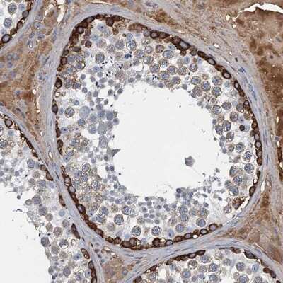 Immunohistochemistry-Paraffin LSM14B Antibody - BSA Free