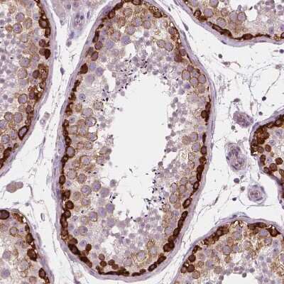 Immunohistochemistry-Paraffin LSM14B Antibody - BSA Free