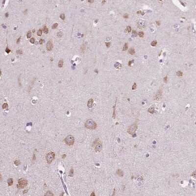 Immunohistochemistry-Paraffin LSM14B Antibody - BSA Free