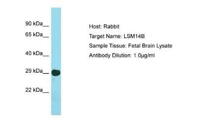 Western Blot: LSM14B Antibody [NBP2-87753] - Host: Rabbit. Target Name: LSM14B. Sample Type: Fetal Brain lysates. Antibody Dilution: 1.0ug/ml