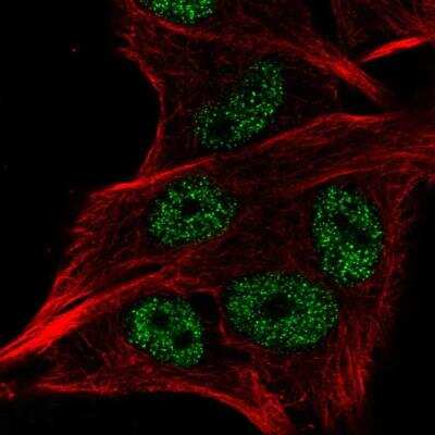 Immunocytochemistry/ Immunofluorescence LSM2 Antibody