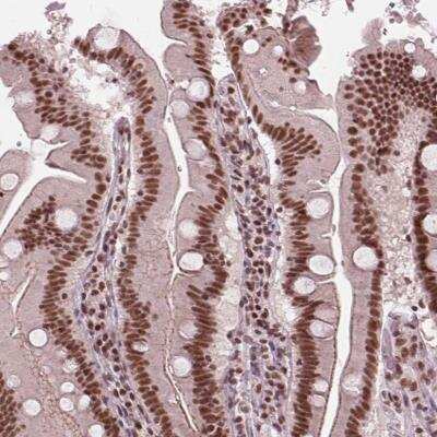 Immunohistochemistry-Paraffin LSM2 Antibody