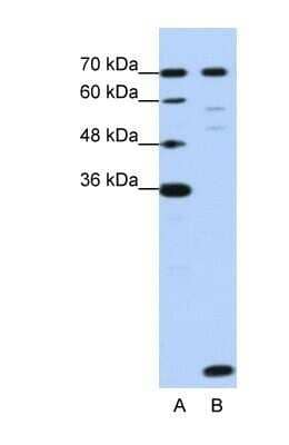 Western Blot: LSM2 Antibody [NBP1-57504] - HepG2 cell lysate, Antibody Titration: 1.25ug/ml