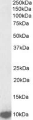 Western Blot: LSM2 Antibody [NBP2-26136] - NBP2-26136 (1ug/ml) staining of K562 lysate (35ug protein in RIPA buffer). Primary incubation was 1 hour. Detected by chemiluminescence.