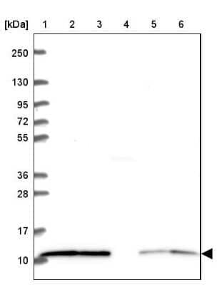 Western Blot LSM2 Antibody