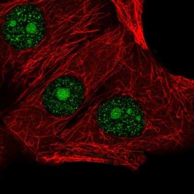 Immunocytochemistry/ Immunofluorescence LSM3 Antibody - BSA Free