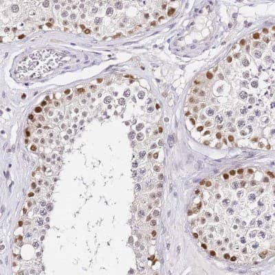 Immunohistochemistry-Paraffin LSM3 Antibody - BSA Free
