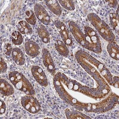 Immunohistochemistry-Paraffin: LSM5 Antibody [NBP1-92082] - Staining of human duodenum shows strong granular cytoplasmic positivity in glandular cells.