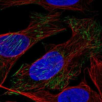 Immunocytochemistry/ Immunofluorescence LSM6 Antibody